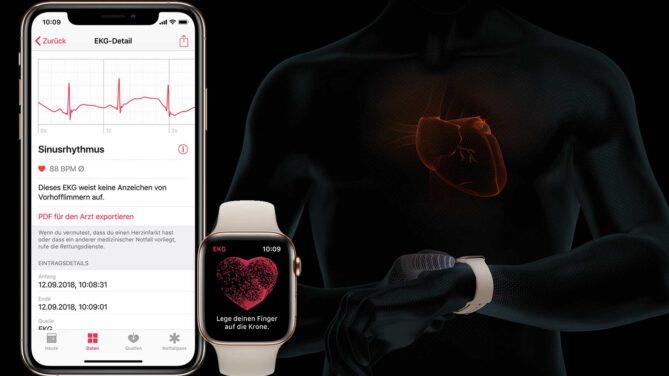 Apple Watch, EKG, iPhone, Vorhofflimmern
