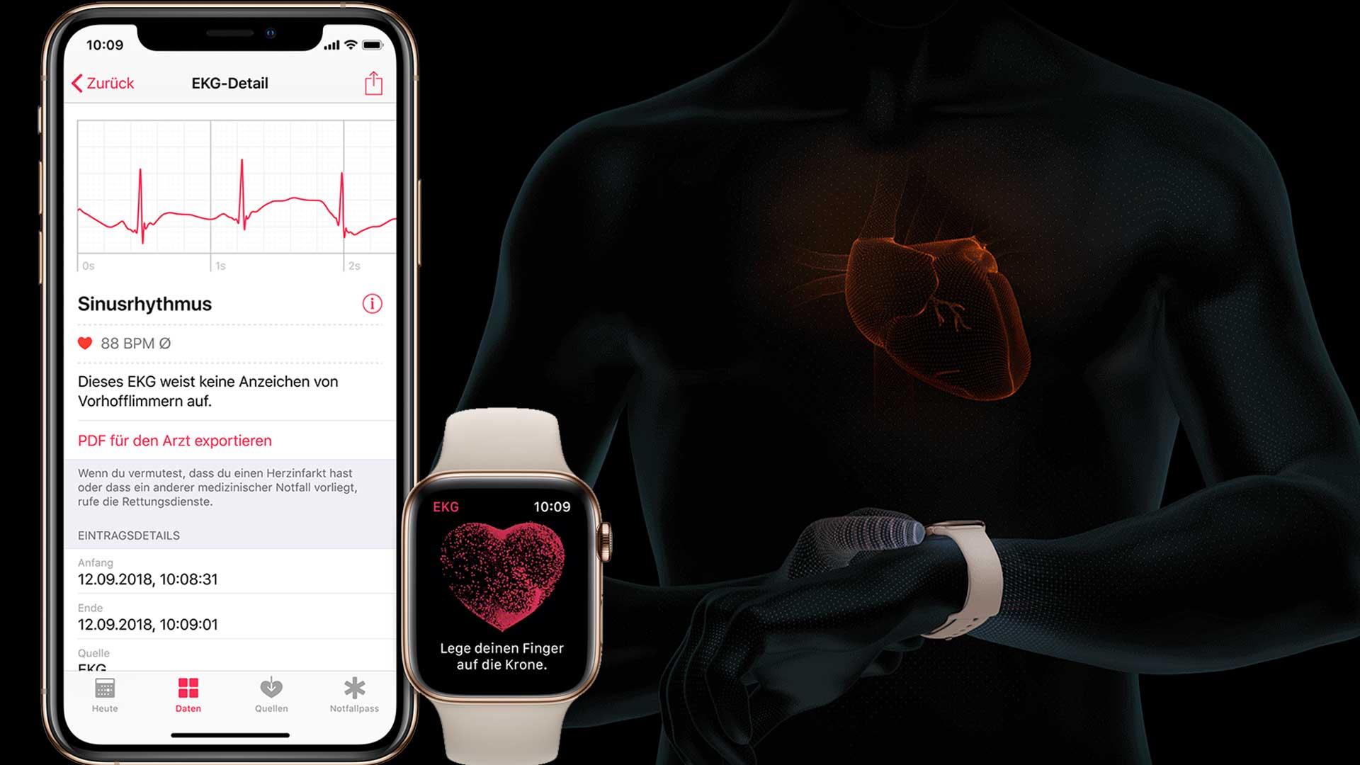 Vorhofflimmern: Die EKG-App & die Apple Watch in der Klinik (Video)