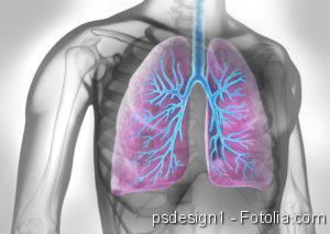 Bronchitis, Lungenerkrankung, Lungenkrebs, Lungenentzündung, Schweres Asthma, Schimmel
