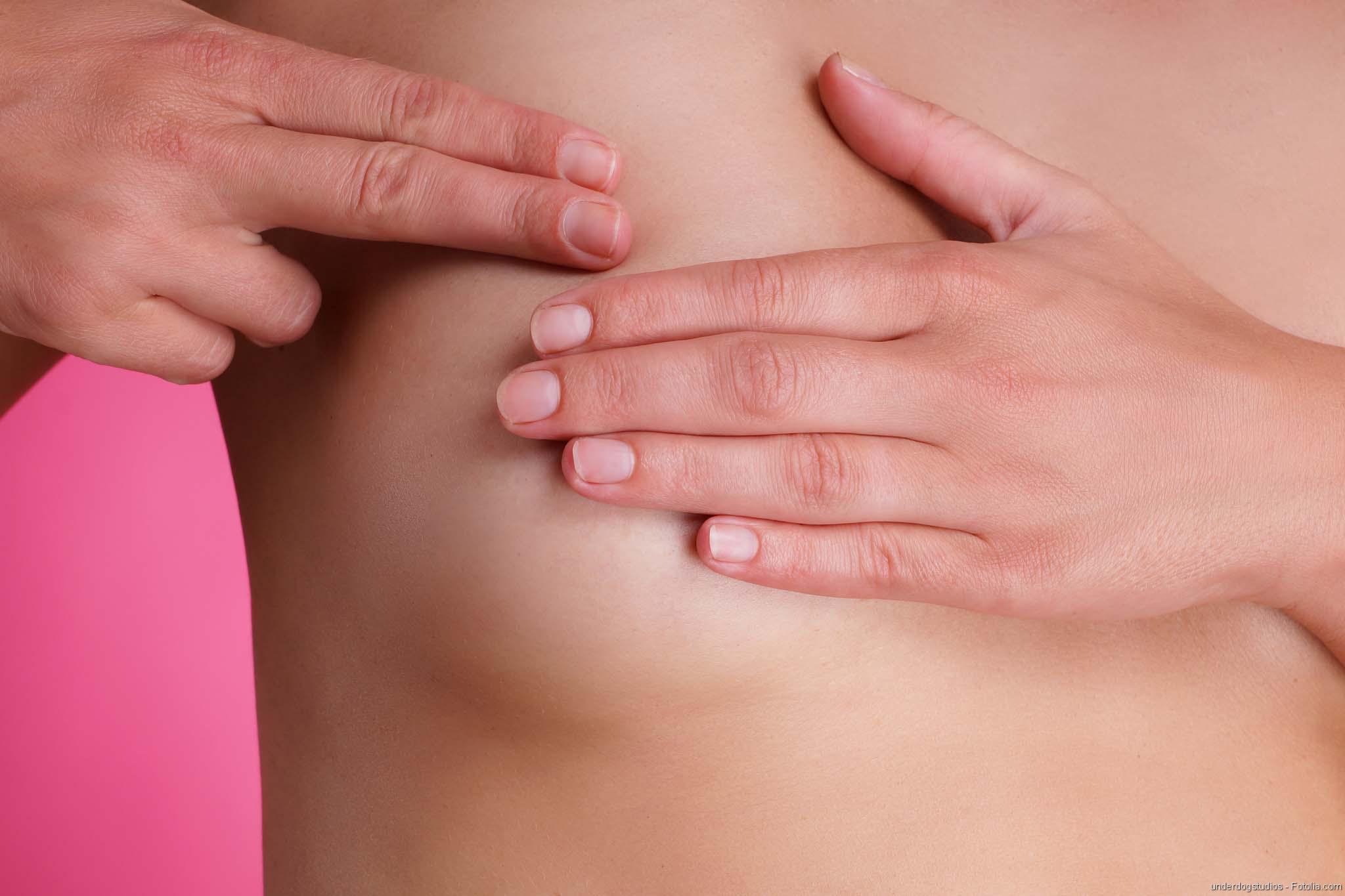 Mammakarzinom. Untersuchung der weiblichen Brust